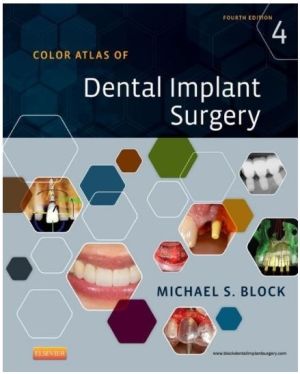 Color Atlas of Dental Implant Surgery, 4th Edition
