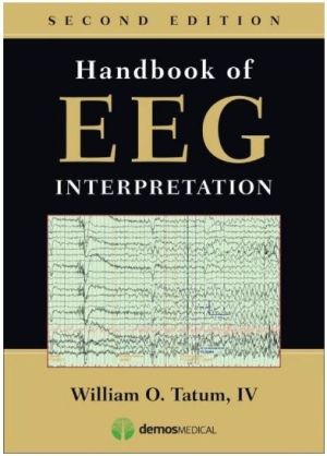 Handbook of EEG Interpretation, 2nd Ed