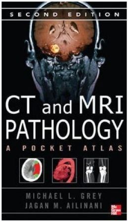 CT & MRI Pathology: A Pocket Atlas, 2nd edition