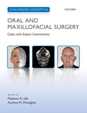 Challenging Concepts in Oral and Maxillofacial Surgery, 1st Edition
