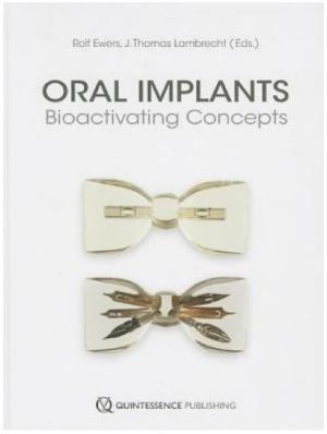 Oral Implants: Bioactivating Concepts, 1st Edition