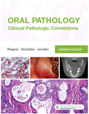 Oral Pathology: Clinical Pathologic Correlations, 7th Edition