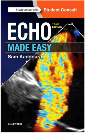 Echo Made Easy, International Edition, 3rd Edition