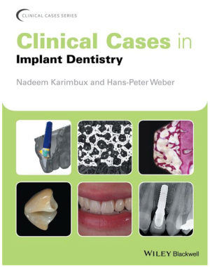Clinical Cases in Implant Dentistry, 1st edition