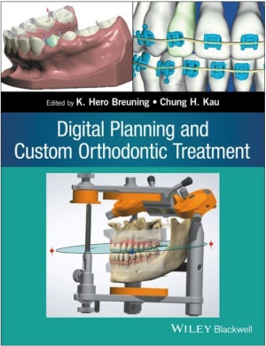 Digital Planning and Custom Orthodontic Treatment, 1st Edition
