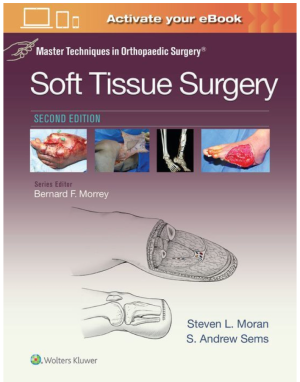 Master Techniques in Orthopaedic Surgery: Soft Tissue Surgery, 2nd Edition