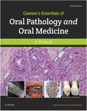 Cawson's Essentials of Oral Pathology and Oral Medicine, International Edition, 9th Edition