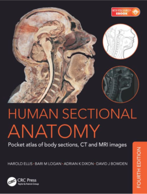 Human Sectional Anatomy: Pocket atlas of body sections, CT and MRI images, 4th edition