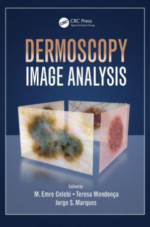 Dermoscopy Image Analysis