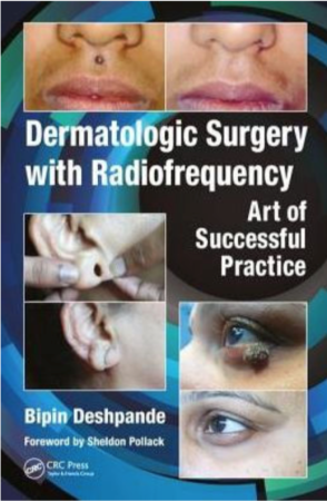 Dermatologic Surgery with Radiofrequency: Art of Successful Practice, 1st Edition