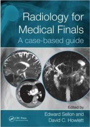 Radiology for Medical Finals: A case-based guide, 1st Edition