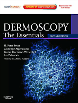 Dermoscopy: The Essentials: Expert Consult - Online and Print, 2nd Edition