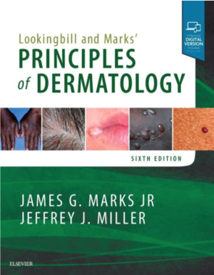 Lookingbill and Marks' Principles of Dermatology, 6th Edition