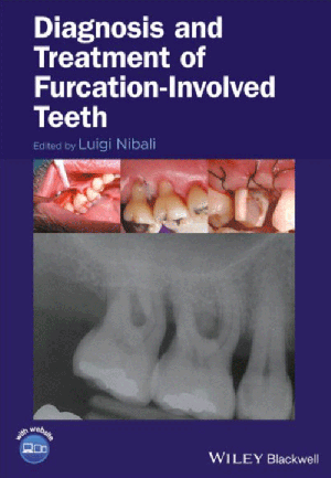 Diagnosis and Treatment of Furcation-Involved Teeth, 1st Edition