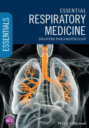 Essential Respiratory Medicine, 1st Edition