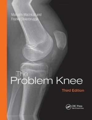 The Problem Knee, 3rd Edition