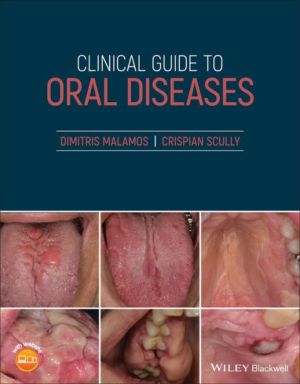 Clinical Guide to Oral Diseases-9781119328117