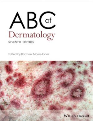 ABC of Dermatology - 9781119488989 