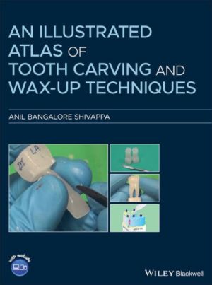 An Illustrated Atlas of Tooth Carving and Wax-Up Techniques, 1st Edition