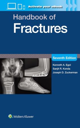 Handbook of Fractures