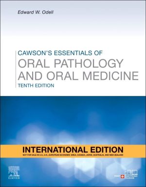 Cawson's Essentials of Oral Pathology and Oral Medicine