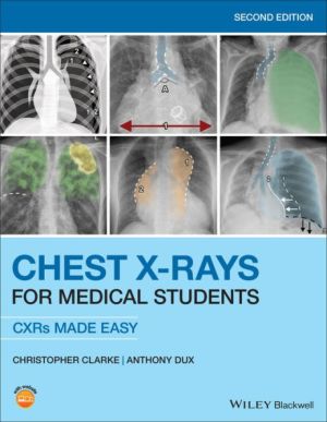 Chest-X-Rays-for-Medical-Students-CXRs-Made-Easy-9781119504153.jpg