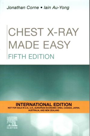 Chest X-Ray Made Easy, International Edition, 5th Edition
