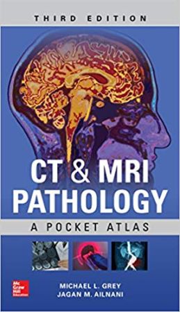 CT & MRI Pathology: A Pocket Atlas, Third Edition, 3rd Edition