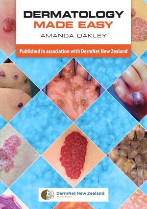 Dermatology Made Easy-9781907904820