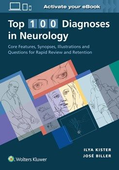 Top 100 Diagnoses in Neurology, 1st Edition