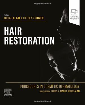 Procedures in Cosmetic Dermatology: Hair Restoration
