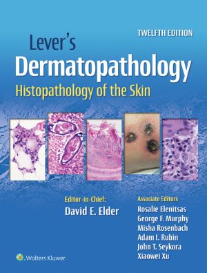 Lever's Dermatopathology: Histopathology of the Skin