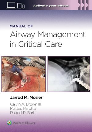 Airway Management in Critical Care