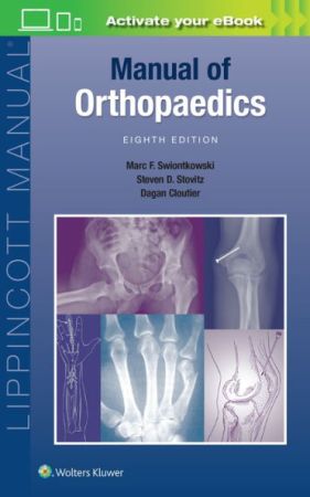 manual-of-orthopaedics-marc-swiontkowski-9781975143350