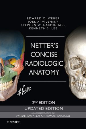 Netter's Concise Radiologic Anatomy Updated Edition, 2nd Edition