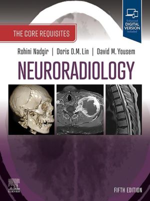 Neuroradiology: The Core Requisites