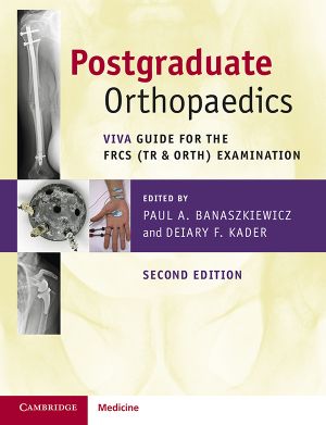 Postgraduate Orthopaedics: Viva Guide for the FRCS (Tr & Orth) Examination