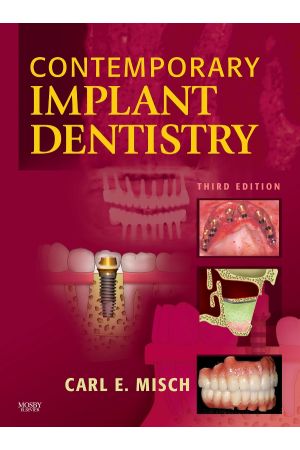 Contemporary Implant Dentistry