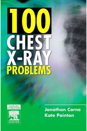 100 Chest X-Ray Problems, International Edition