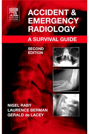 Accident and Emergency Radiology:  A survival guide 2nd Edition