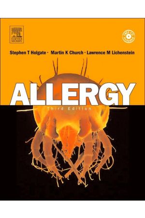 Allergy, 3rd Edition