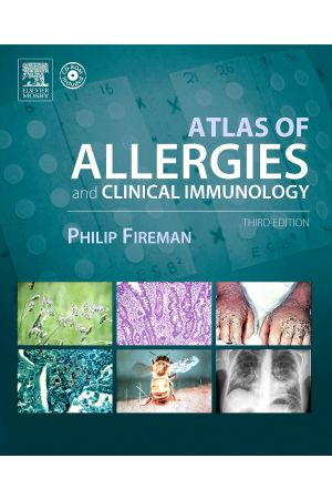 Atlas of Allergy and Clinical Immunology 3rd Edition