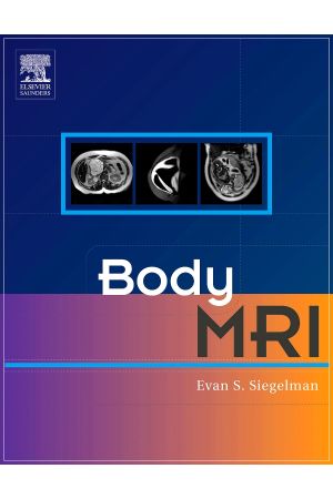 Body MRI