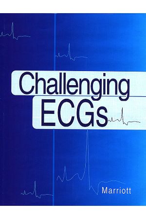 Challenging ECGs