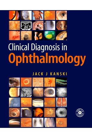 Clinical Diagnosis in Ophthalmology