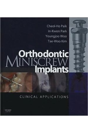 Orthodontic Miniscrew Implants