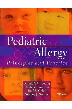 Pediatric Allergy: Principles and Practice