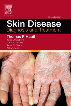 Skin Disease, 2nd Edition: Diagnosis and Treatment
