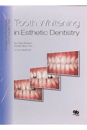 Tooth Whitening in Esthetic Dentistry: Principles and Techniques, 1st Edtion