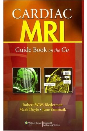 Cardiac MRI: Guide Book on the Go